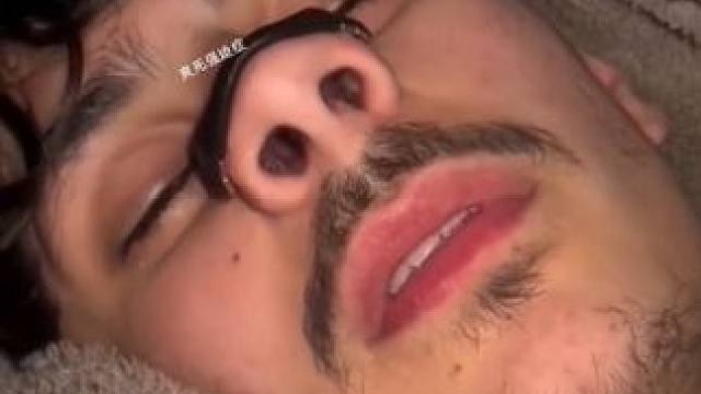 #止鼾 #止鼾器 #睡觉打呼噜 #睡觉打鼾