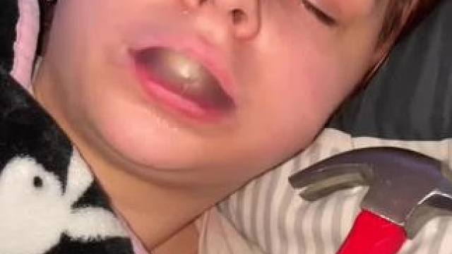 #止鼾 #止鼾器 #睡觉打呼噜 #打呼噜怎么治