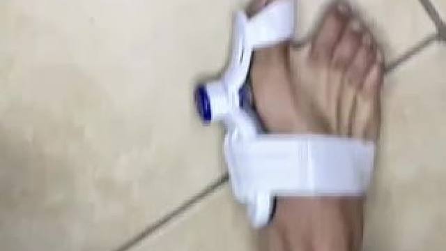 #脚趾矫正器 脚趾矫正器，拇指外翻纠正，男女士大脚骨脚指内翻分趾器 #拇指外翻  #轻度拇指外翻怎么