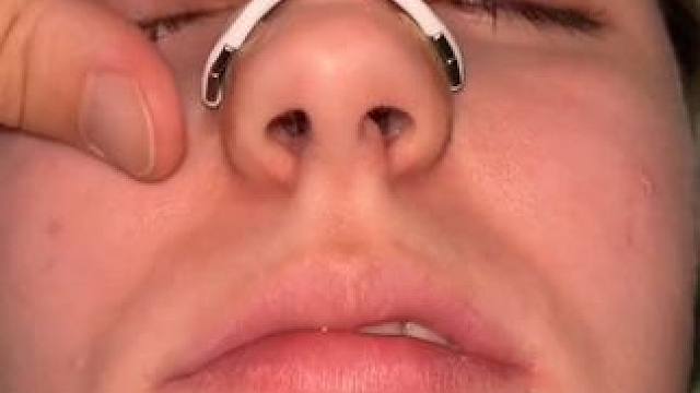 #止鼾 #止鼾器 #睡觉打呼噜 #打呼噜怎么治