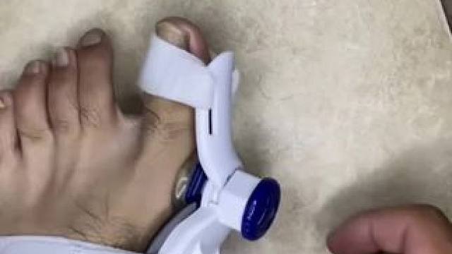 #脚趾矫正器 脚趾矫正器，拇指外翻纠正，男女士大脚骨脚指内翻分趾器 #拇指外翻  #轻度拇指外翻怎么