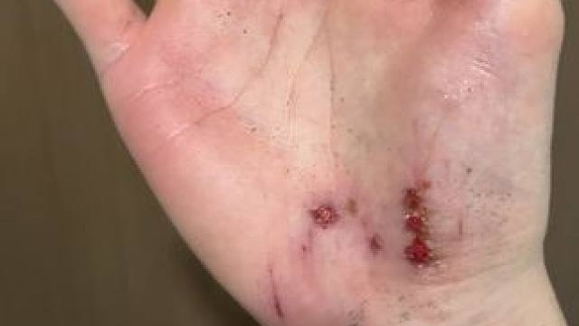 鱼跃救过的球，你会后悔吗 #羽毛球