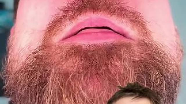 #止鼾 #止鼾器 #睡觉打呼噜 #打呼噜怎么治