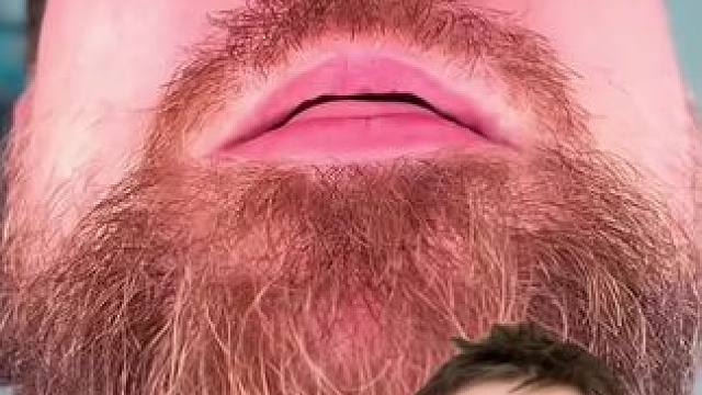 #止鼾 #止鼾器 #睡觉打呼噜 #打呼噜怎么治