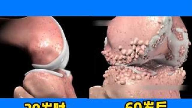 #膝盖痛 #膝盖 #膝关节 #半月板损伤