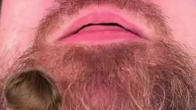 #止鼾 #止鼾器 #睡觉打呼噜 #打呼噜怎么治