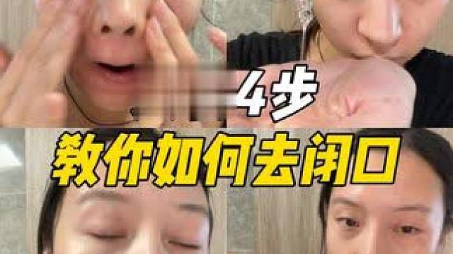 额头长闭口，下巴长粉刺，今天4招一定帮你清干净！#闭口#粉刺#护肤#Alra嫩豆腐精华