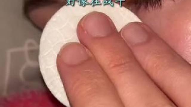 #止鼾 #止鼾器 #睡觉打呼噜 #打呼噜怎么治