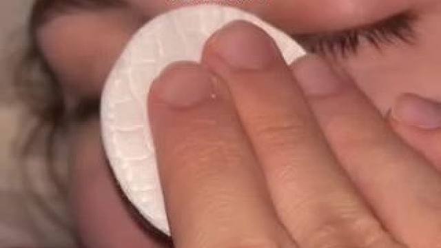 #止鼾 #止鼾器 #睡觉打呼噜 #打呼噜怎么治