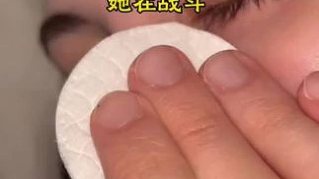 #止鼾 #止鼾器 #睡觉打呼噜 #打呼噜怎么治