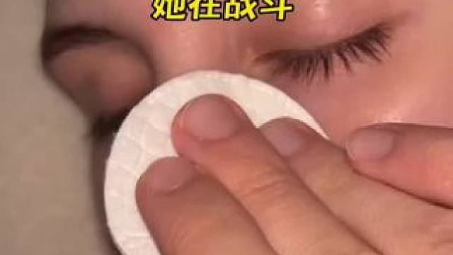 #止鼾 #止鼾器 #睡觉打呼噜 #打呼噜怎么治