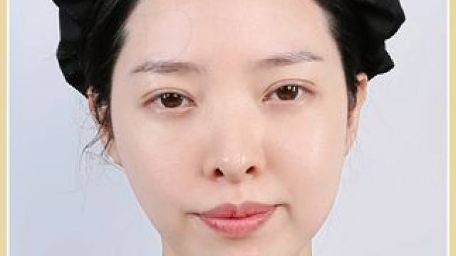 让小v脸还能更惊艳的线雕原液#外国媳妇#金爱麟夫妇#提拉