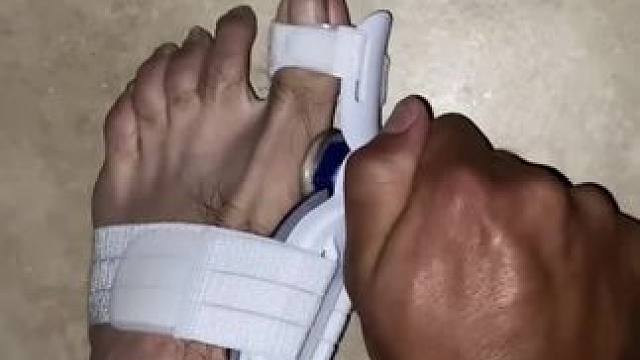 #脚趾矫正器 脚趾矫正器，拇指外翻纠正，男女士大脚骨脚指内翻分趾器 #拇指外翻  #轻度拇指外翻怎么