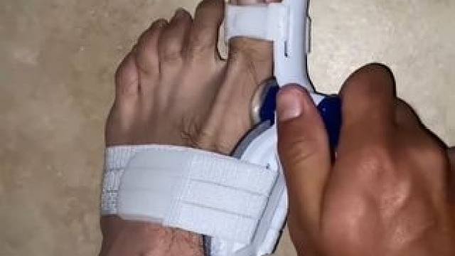 #脚趾矫正器 脚趾矫正器，拇指外翻纠正，男女士大脚骨脚指内翻分趾器 #拇指外翻  #轻度拇指外翻怎么