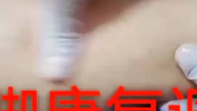 习惯性崴脚调理，一个月三次崴脚，看看效果#调理身体 #运动康复