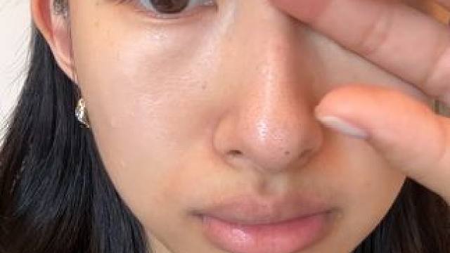 用了这个黑头水 黑头都长慢了！化妆鼻翼周围真的一点不卡！ #好物分享 #黑头 #粉刺 #好皮肤养出来