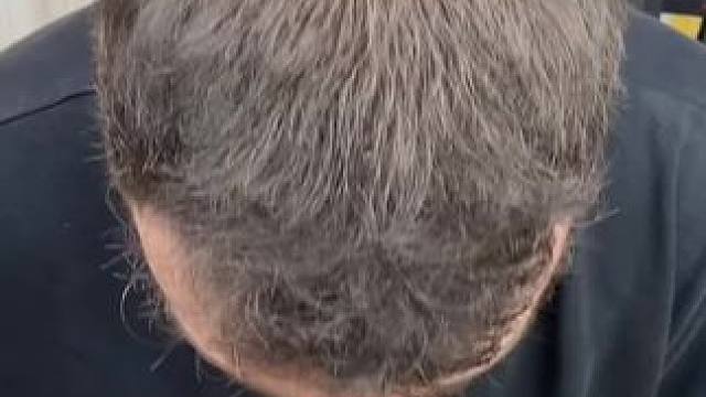 不会踩雷的#发际线泥 对新手友好，软糯丝滑好上色，防水防汗不流黑汤，轻松打造妈生小绒毛～#发际线粉