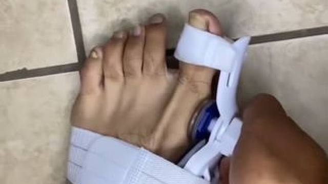 #脚趾矫正器 脚趾矫正器，拇指外翻纠正，男女士大脚骨脚指内翻分趾器 #拇指外翻  #轻度拇指外翻怎么