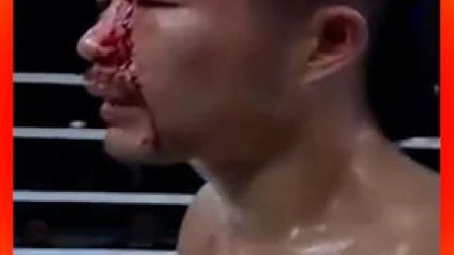 中国小伙苦练10年神龙摆尾，一脚踢裂日本人眉骨 #