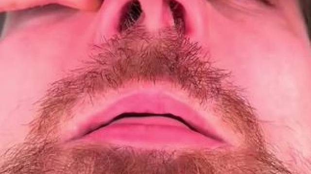 #止鼾 #止鼾器 #睡觉打呼噜 #打呼噜怎么治