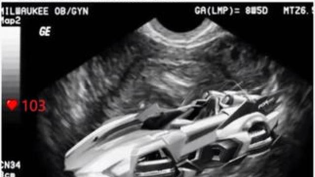 祝新的一岁生日快乐继续加油～#北程德芙一哥