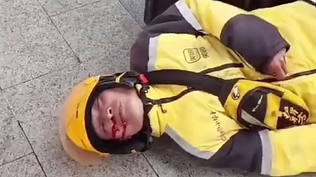 这么不小心，注意安全第一。