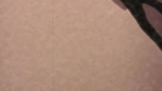 我是一个黑绝的天花！ 我是一个黑绝的天花！#火影忍者 #火影忍者手游