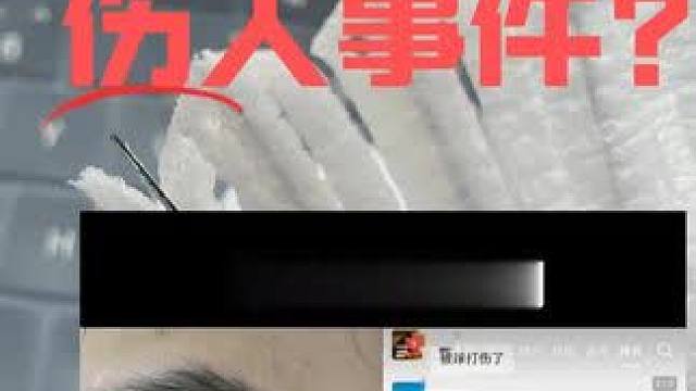 碳音球伤人事件？ 碳音球那碳纤维确实有点尖利，各位羽球人还是注意一下哦#羽毛球 #碳音羽毛球