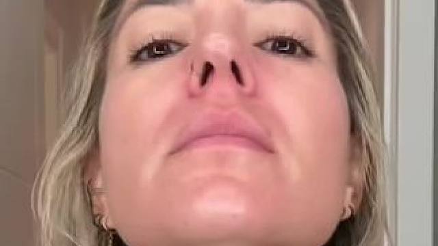 #止鼾 #止鼾器 #睡觉打呼噜 #打呼噜怎么治