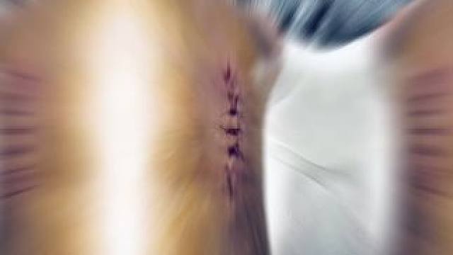 擂台赋予我的一切 都是奖赏和勋章！麒麟军家人们，不用担心，我很好！#格斗 #王赛