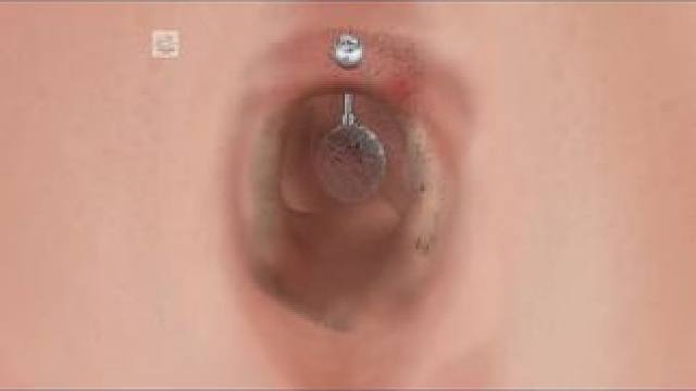 解压清理肚脐眼#解压#清理#下饭