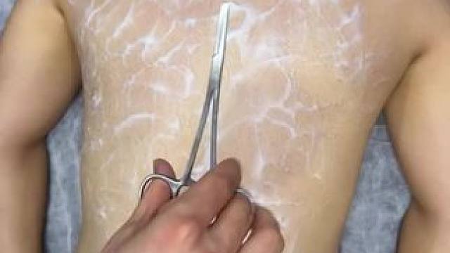 #拔罐#养生#解压