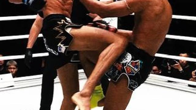 救命！阿纳尼这大长腿要怎么防啊？