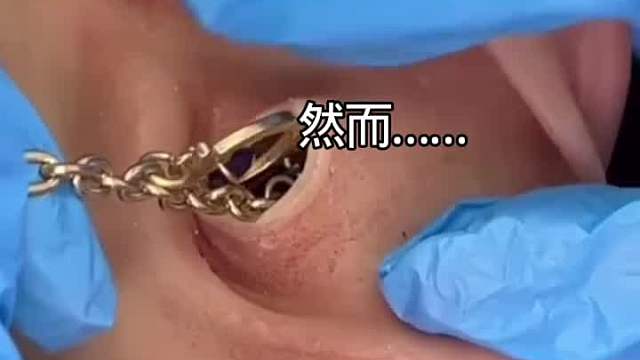 第一次见耳洞大！