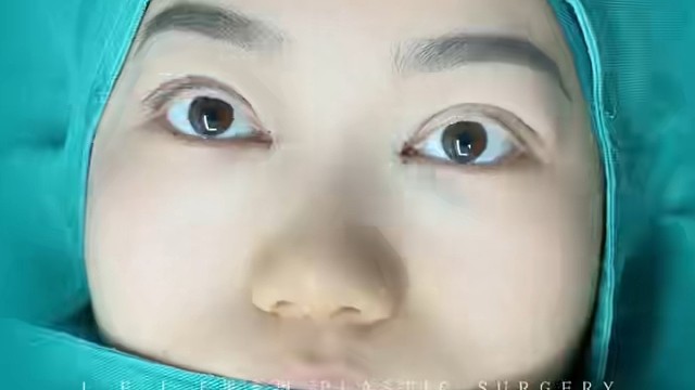 双眼皮灵动自然，让眼睛更有层次感