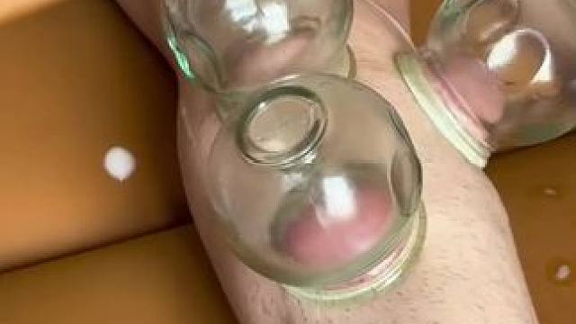 腿部拔罐#拔罐#按摩