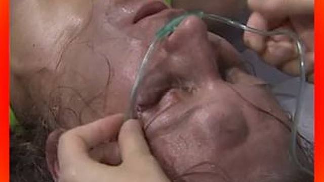 张伟丽一脚让对手躺地上奄奄一息，医护赶紧插管抢救