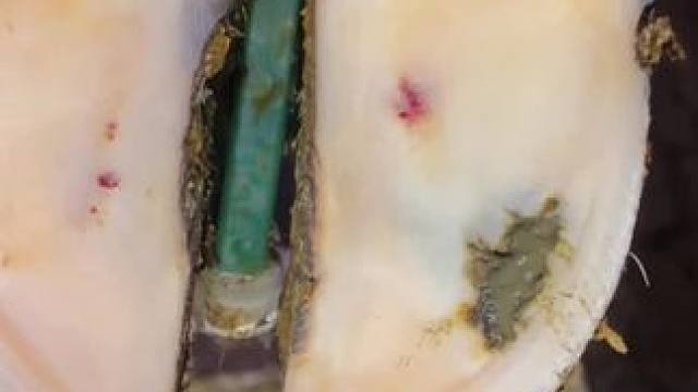 脚尖这种位置病灶更是深藏不漏