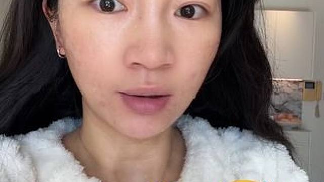 战痘日记仅供参考，如有不适请随时就医！破皮的痘千万不要涂啊！