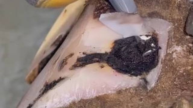 白线病变虽然常见，但是延伸这么深就少见了