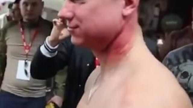 扇耳光使劲往脖子上招呼，脸和脖子都打肿了！