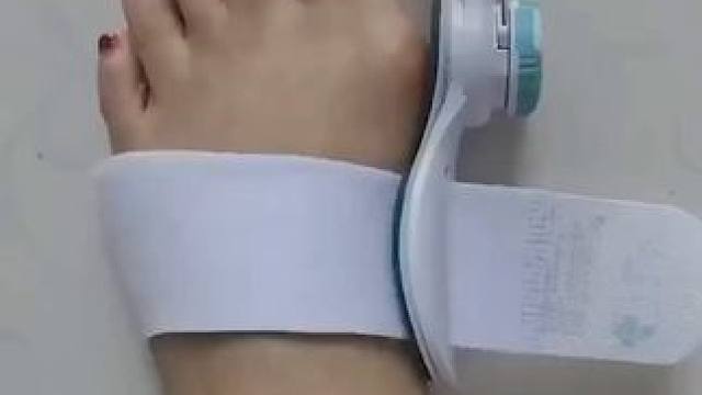 #脚趾矫正器 脚趾矫正器，拇指外翻纠正，男女士大脚骨脚指内翻分趾器 #拇指外翻  #轻度拇指外翻怎么