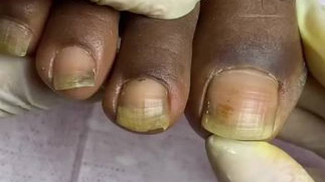 #修脚#解压#美甲