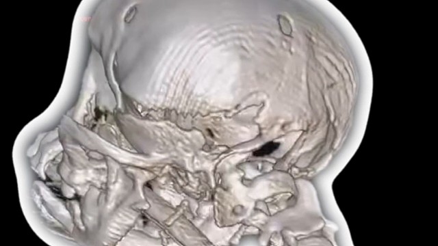 这是病，你知道吗？#宠物知识 #狗 #茶杯犬