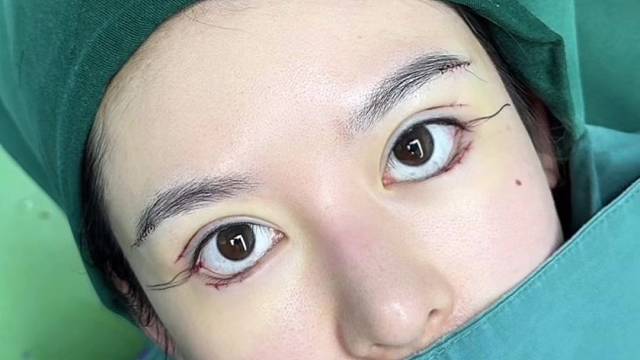 大眼综合