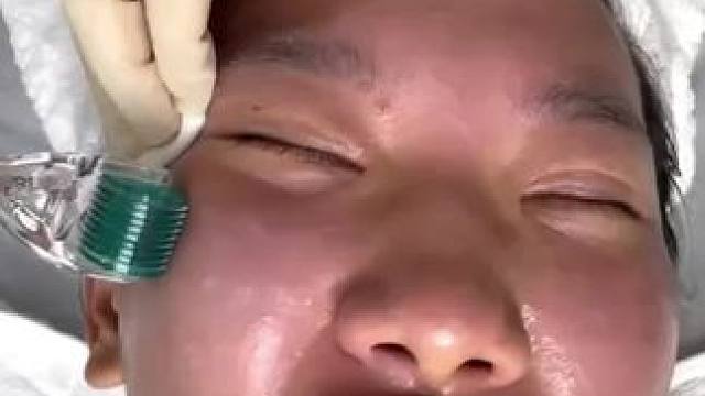 为了变美，女人能对自己有多狠心？
