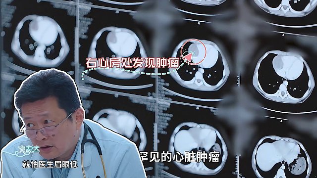 刀尖上的舞者，拆除“心脏炸弹”。