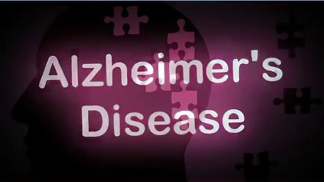 阿尔兹海默症2