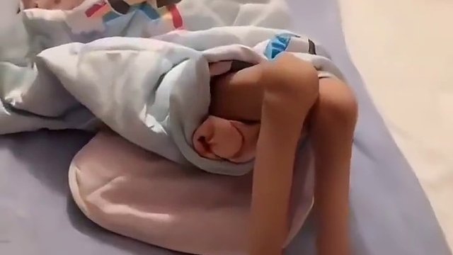 运动神经元病患者，男性今年46岁，一年前通过肌肉活检确诊，但在这之前，患者便渐渐出现无力症状，因为前